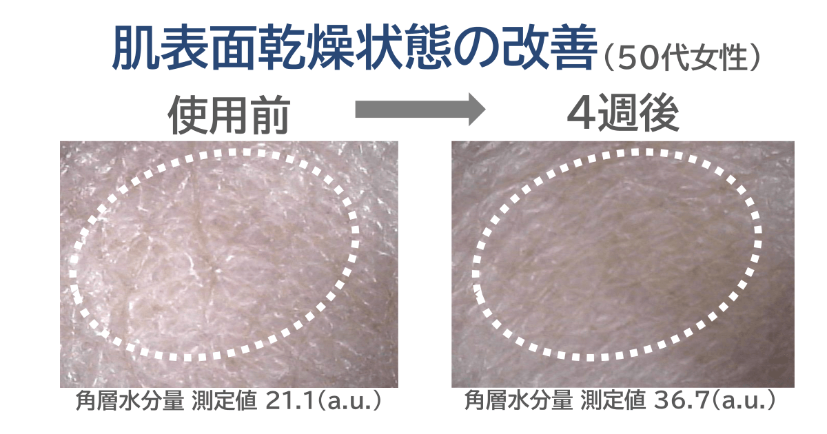 YUKIME®による肌表面乾燥状態の改善