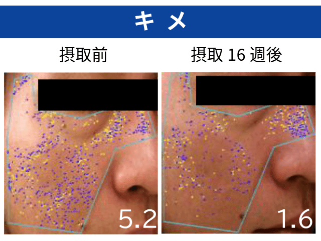 UNIFINE®摂取による美肌効果_キメ