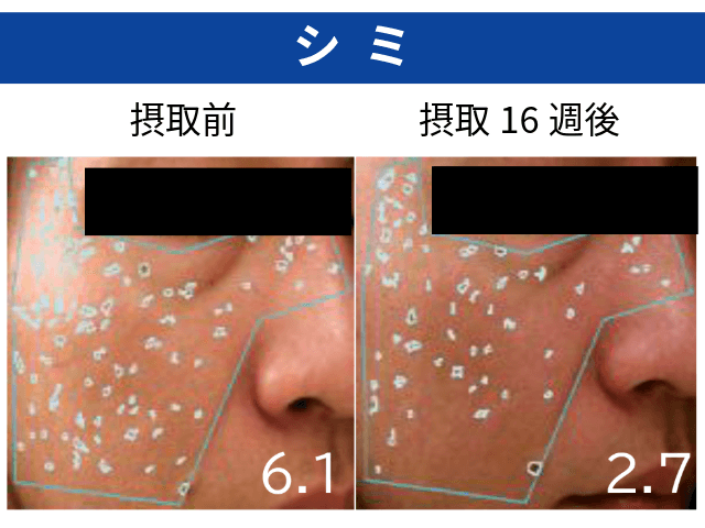 UNIFINE®摂取による美肌効果_シミ