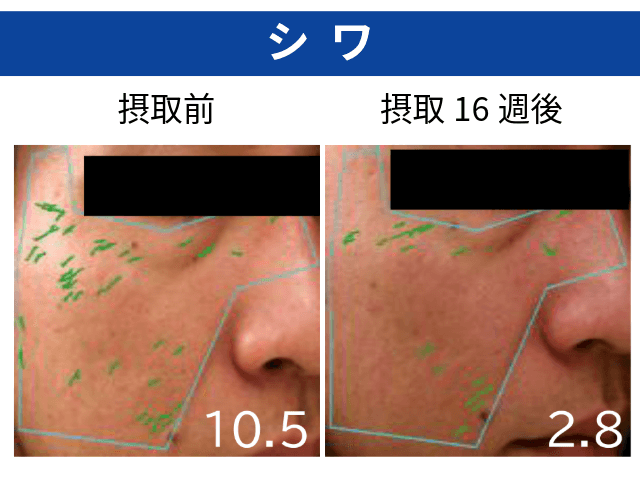 UNIFINE®摂取による美肌効果_シワ