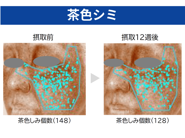 ROSE CRYSTA®-70摂取による美肌効果_シミ改善